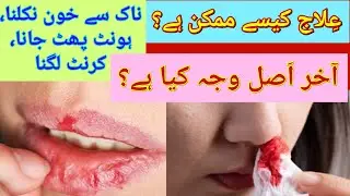 Extreme dry wind in Pakistan | Nose bleeding | First aid | Healthy tips by Ayesha