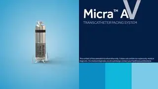 Now at Glens Falls Hospital - Medtronic Micra AV