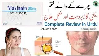 Maxinoin Capsule | Isotretinoin capsule uses in Urdu | Remove Acne Scars Treatment