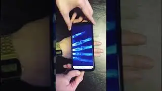 X-ray Camera Body Scanner App | Real or Fake?