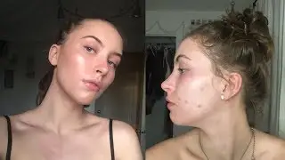 skin care routine 2017 // acne prone