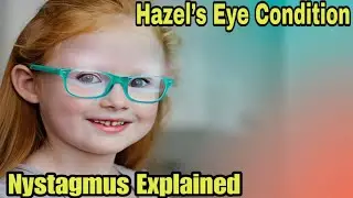 Hazel Busby&rsquo;s Nystagmus Explained | OutDaughtered: What the Condition Is, Symptoms & Treatment