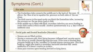Common Cold  Influenza  Cough  - community pharmacy صيدلة المجتمع