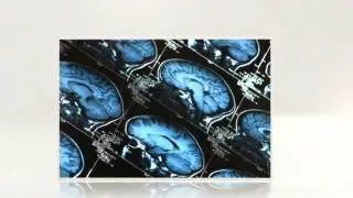 Autism Supplement to Help with Mitochondrial Dysfunction - Mito Medical