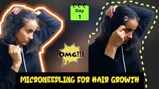 Microneedling For Hair Growth | Derma Roller For Hair Growth 