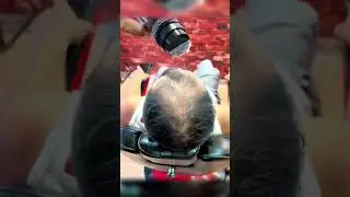 Get Fuller Hair with Toppik & Caboki in Quetta  #toppik #hairbuildingfibres #hairfibres