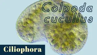 Colpoda cucullus and other Colpodidae ciliates (Ciliophora)