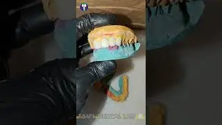 🎯🧑&zwj;🏭Art Of Ceramic Teeth🥶|🧑&zwj;⚕️Happy Smile😁|😵&zwj;💫Dentist Office👀| Tamil Dental Lab | #ceramictooth #art