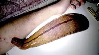 10 Amazing Facts About Leeches!
