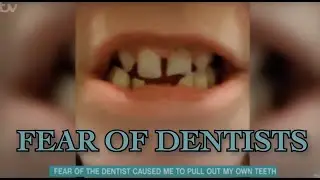 Overcoming A Dental Phobia & Low Confidence I Nik & Eva Speakman