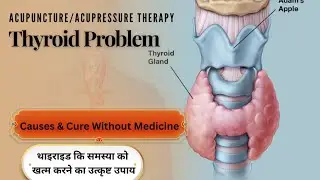 थायराइड को ठीक करने का का रामबाण उपाय। Powerful Acupuncture point for Thyroid Diseases.