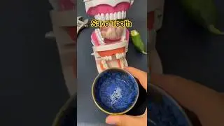 Fix Your Teeth Instantly with This AMAZING Repair Kit | #tools #viral #shorts
