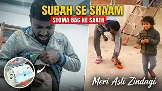 Subah Se Shaam Stoma Bag Ke Saath Meri Asli Zindagi 🎒 | Day In My Life | Nitish Unpaused
