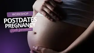 Postdates Pregnancy Workshop