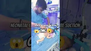 neonatal Endotracheal Tube Suction #hospital #viralvideo #nicu #newborn #shortvideo #babygirl#shorts