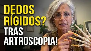 La Verdad sobre la Artroscopia de Mu&ntilde;eca y su Impacto en los Dedos