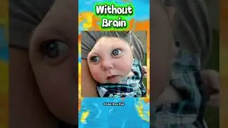 Born Without a Brain? 🧠 5 Rare Human Conditions #shorts #youtubeshorts #shortsfeed