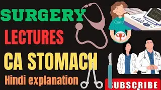 CARCINOMA OF STOMACH SURGERYLECTURE||CA STOMACH||GASTRIC CARCINOMA LECTURES|SYSTEMIC SURGERYLECTURES