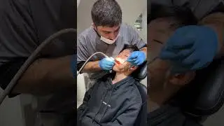 Лечение &laquo; собачьего пятна&raquo; поверхностный кариес )