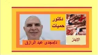 تحليل الإيدز و نقص الوزن | HIV test and weight loss