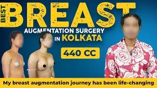 Best Breast Augmentation Surgery in Kolkata|Boob Enlargement Clinic in India|440 cc| Before - After
