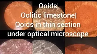 Ooids| ooids in thin section under optical microscope|  Oolitic limestone