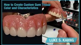 How to Create Custom Gum Tissue Color and Characteristics