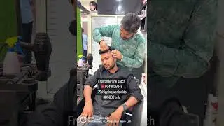 Front hair Line Patch sambhaji nagar | only hair line loss | hair wig | Hair Patch |#hairloss #hair