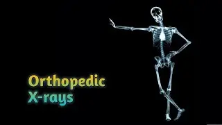 X-ray Table Viva (1) - MS/DNB Orthopedic Practical Examination