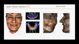 Obi scanner, casi clinici con scanner facciale!