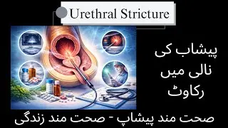 Urethral stricture|A common urinary problem| Narrowing the Urethra| پشاب کی نالی کی تنگی ۔رکاوٹ۔علاج