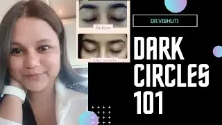 DARK CIRCLES 101