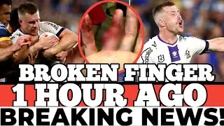 CAMERON MUNSTER SIDELINED WITH Finger INJURY AFTER MELBOURNE Storm's NRL Opener Win | Storm Res...