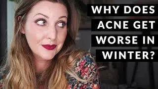 Why Does Acne Get Worse In Winter? // Skyn Therapy