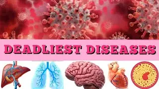 The Top Ten Deadliest Diseases in Human History