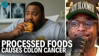 PROCESSED FOODS CAUSES COLON CANCER.. study found  colon cancer as early at your 20s from bad foods