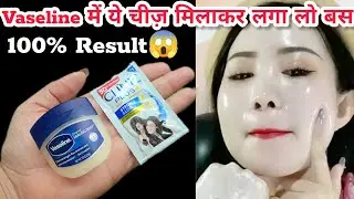 Vaseline को रात में बस इस तरीके से लगा लो चेहरा दूध जैसा गोरा हो जाएगा कोई भी यक़ीन नहीं करेगा