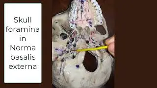 skull foramina in norma basalis externa (in 1 min)