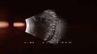 ABSolu - A-Scan / B-Scan & UBM  (Quantel Medical)