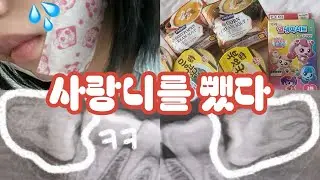 공포의 사랑니 발치 브이로그 💉🦷🔧 (양쪽 두개를 한번에 빼면 어떻게 될까?) | 사랑니 꿀팁 | 사랑니 치과 추천 | 사랑니 음식 | 빨리 회복하는 법