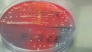 Staphylococcus saprophyticus colony morphology on CLED agar