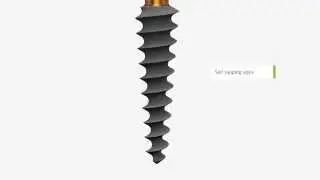 Compressive Implants