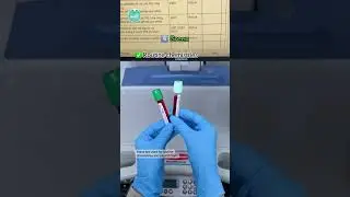 Order of Lab Draw 🩸🧪