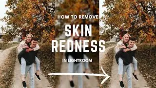Как убрать красные оттенки кожи в Lightroom