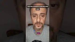 Please we really need your support #goviral #viral