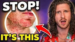 You Don’t Have Acne. You Have THIS!