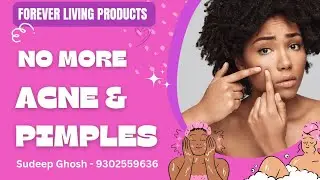 Escape Acne / Pimple Nightmare Forever | Digital Sudeep Shares Skincare Routine
