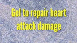 Injectable gel to repair damage after a heart attack