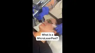 What is a MicroLaserPeel?