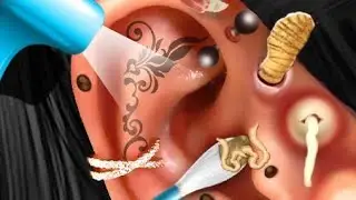ASMR Treatment of Ear Cleaning Do Like Subscribe #viral #asmr #viralvideo #video  #cleaning #status